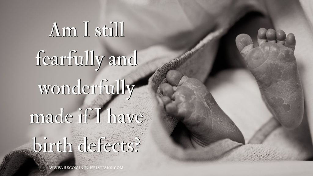 Are you fearfully and wonderfully made if you have birth defects?